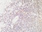 Calcitonin Polyclonal Antibody